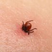 Rekordowa liczba zachorowań. W 2016 r. odnotowano prawie 56 proc. więcej zachorowań na boreliozę niż