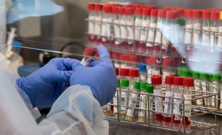 PILNE: Koronawirus w Polsce: 15 tys. nowych zakażeń. Zmarło 156 osób