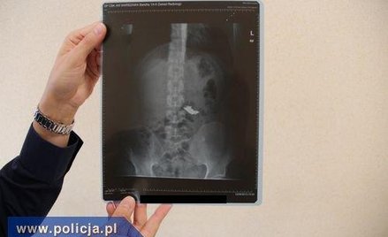 Ukradł łańcuszek. Na widok policji... połknął go