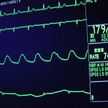 Medicalgorithmics mocniej wchodzi do USA
