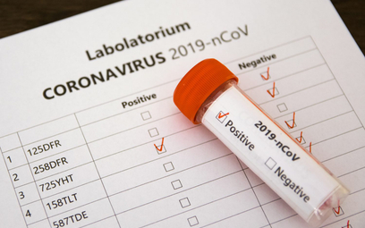 Lubelska spółka rejestruje autorskie testy na koronawirusa