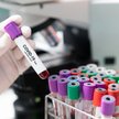 WHO żąda od Chin "przejrzystości". Chodzi o genezę COVID-19