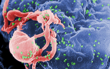 Próba stworzenia szczepionki przeciw HIV zakończona fiaskiem