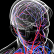 Neuronami w parkinsona