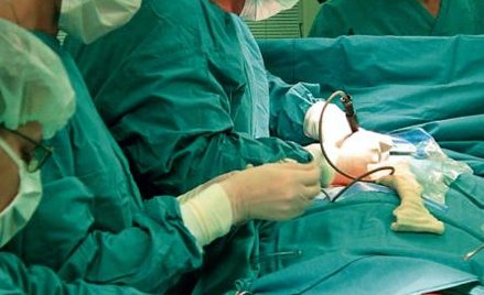 Żadnego kontraktu nie straciliśmy, ale musiałem obniżać ceny proponowane NFZ, by wygrać z konkurencj