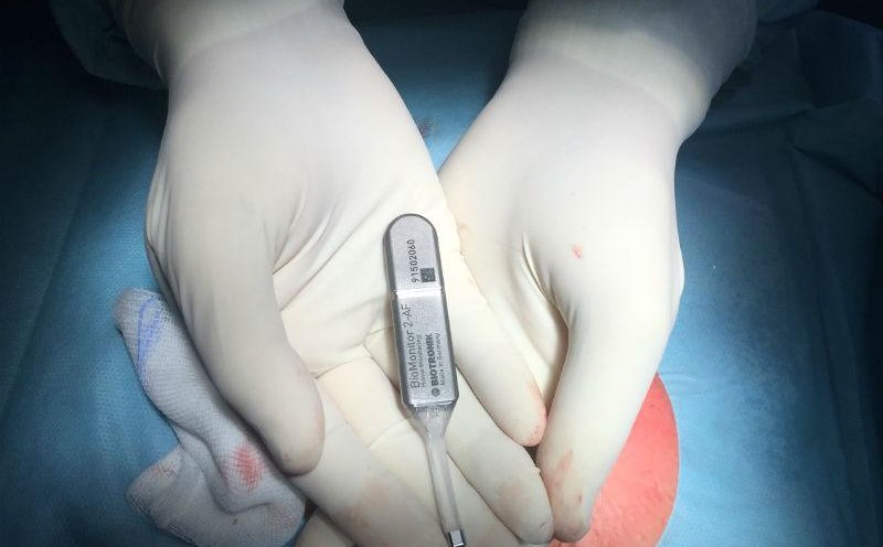 Okazje dla polskiego biznesu technologii medycznych do zaistnienia w Irlandii