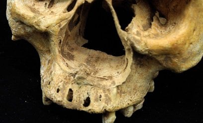 Czaszka sprzed 700 lat może potwierdzać brutalną karę w Chinach