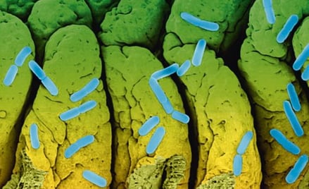 Escherichia coli, pospolita i niegroźna bakteria, czasem uzbraja się w niebezpieczną toksynę