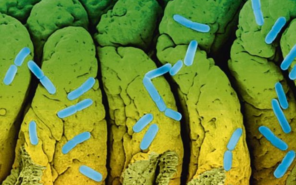 Escherichia coli, pospolita i niegroźna bakteria, czasem uzbraja się w niebezpieczną toksynę