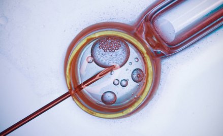 Koniec z finansowaniem in vitro