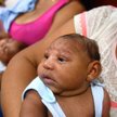 Wirus Zika powoduje zaburzenia rozwoju neurologicznego