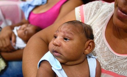 Wirus Zika powoduje zaburzenia rozwoju neurologicznego
