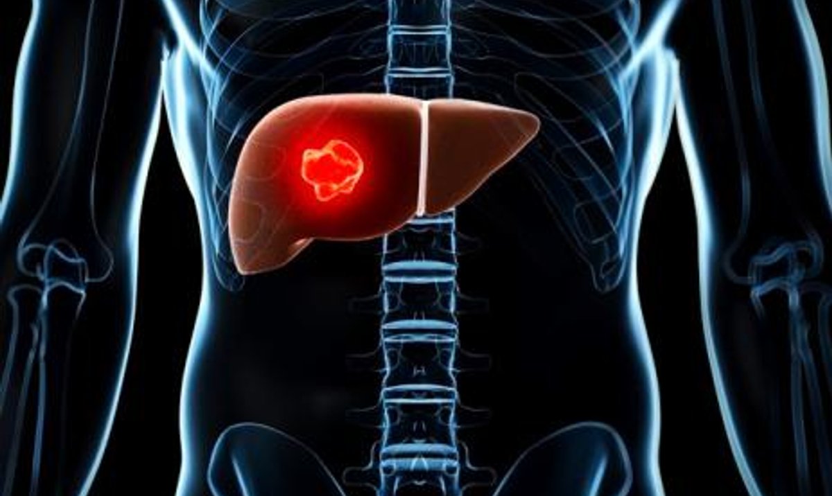 Wirusowe zapalenie wątroby typu C leczenie rp.pl