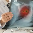 Rak płuca nie może czekać na diagnozę