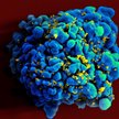 Limfocyt zaatakowany przez wirusy HIV