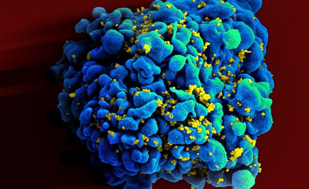 Limfocyt zaatakowany przez wirusy HIV