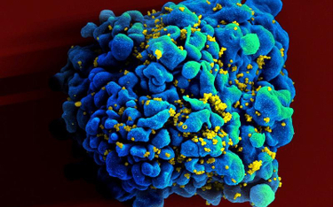 Limfocyt zaatakowany przez wirusy HIV