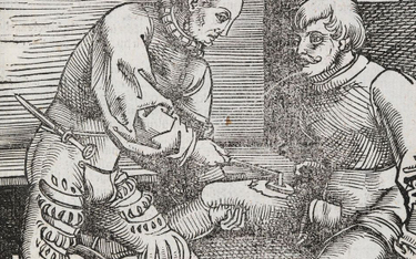 Ból towarzyszący przyżeganiu odpowiadał za popularność tej metody. Grafika z 1530 roku przedstawiają