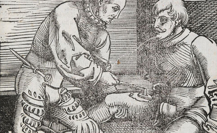 Ból towarzyszący przyżeganiu odpowiadał za popularność tej metody. Grafika z 1530 roku przedstawiają