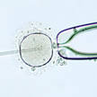Zapłodnienie in vitro pozostaje jedynym sposobem dla części niepłodnych par chcących mieć własne dzi