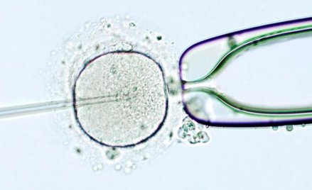 Zapłodnienie in vitro pozostaje jedynym sposobem dla części niepłodnych par chcących mieć własne dzi