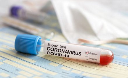 Lek przeciw malarii pomoże w walce z COVID-19?