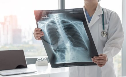 Od 1 października osoby z grupy podwyższonego ryzyka będą mogły skorzystać z bezpłatnej niskodawkowe