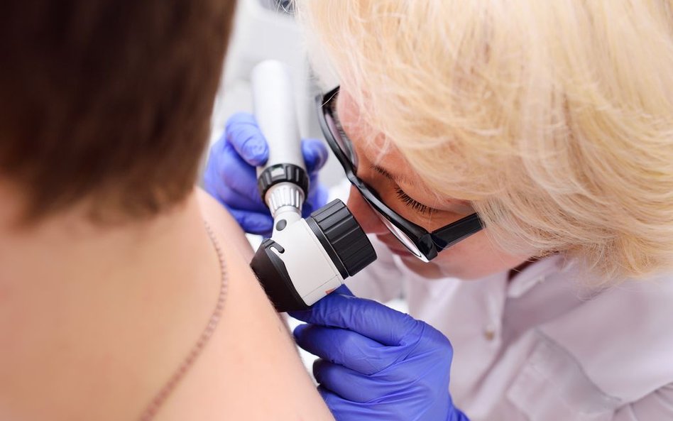 Badanie dermatoskopem rozwieje wątpliwości co do charakteru zmian na skórze