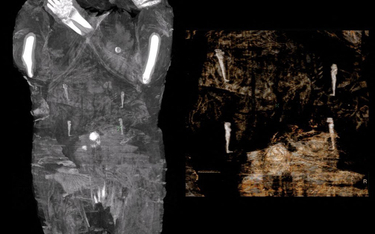 Mumia ciężarnej. Przełomowe odkrycie polskich naukowców