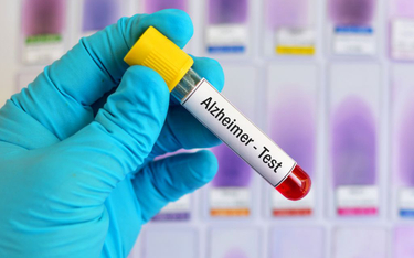 Niestety nie ma jeszcze testów, które pozwalają identyfikować osoby narażone na rozwój alzheimera pr
