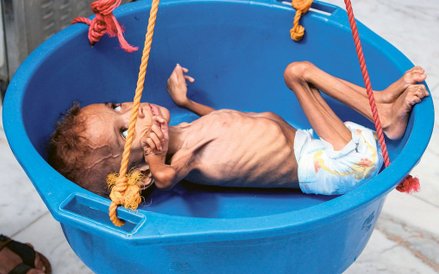 Wojna domowa w Jemenie przynosi cierpienie cywilom