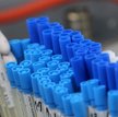 Nowy szef sanepidu w województwie śląskim. Ma opanować sytuację