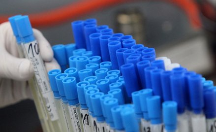 Nowy szef sanepidu w województwie śląskim. Ma opanować sytuację