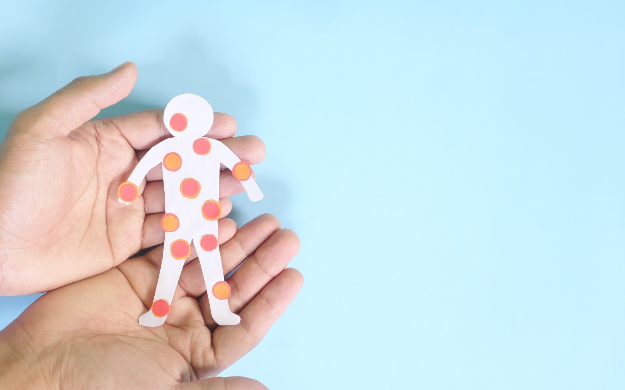 Choroby zakaźne wracają. Kilkukrotny wzrost liczby przypadków WZW typu A