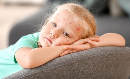 Odra jest problemem nie tylko na Samoa, ale też w Europie