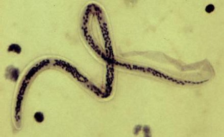 Nicień Filaria Bancrofta wywołujący słoniowaciznę
