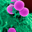 Gronkowce odporne na antybiotyki (MRSA) są obecnie jednym z najważniejszych problemów dla szpitali