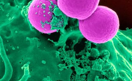 Gronkowce odporne na antybiotyki (MRSA) są obecnie jednym z najważniejszych problemów dla szpitali