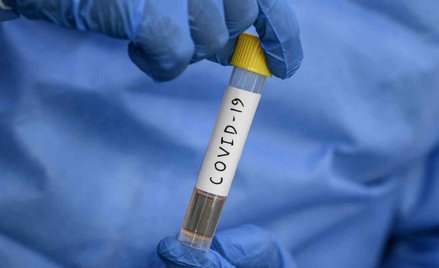 Początek testów kolejnej szczepionki przeciw COVID-19 na ludziach