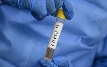 Początek testów kolejnej szczepionki przeciw COVID-19 na ludziach