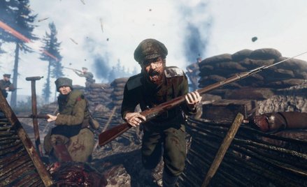 Rekonstrukcja konsolowa