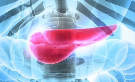 Rak trzustki jest jednym z najbardziej podstępnych i trudnych w leczeniu nowotworów.