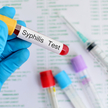 Kiłę (syfilis) diagnozuje się w Polsce coraz częściej. Często jednak ten fakt jest ukrywany