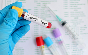 Kiłę (syfilis) diagnozuje się w Polsce coraz częściej. Często jednak ten fakt jest ukrywany