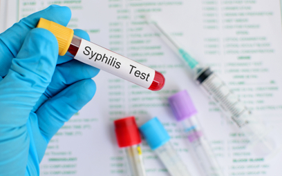 Kiłę (syfilis) diagnozuje się w Polsce coraz częściej. Często jednak ten fakt jest ukrywany
