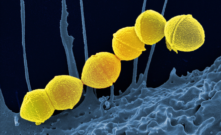 Bakteria Streptococcus Pyogenes