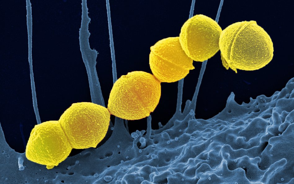 Bakteria Streptococcus Pyogenes