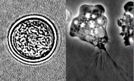 N. fowleri występuje w postaci cysty i dwóch postaciach trofozoitów (wiciowej i pełzakowej)