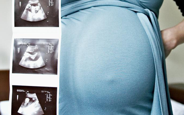 Petycja: Niech kobiety w ciąży też korzystają z 500+