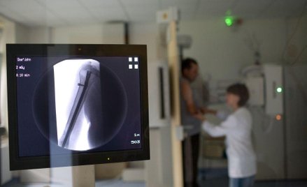 Prześwietlenie rentgenem niebezpieczne?